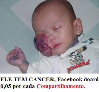 Foto de um bebê com tumor no rosto circula pelo Facebook! (enviada por e-mail para o E-farsas)